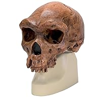 3B Scientific VP754/1 Broken Hill or Kabwe Anthropological Skull Model, 8.3