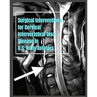 Surgical Interventions for Cervical Intervertebral Disc Disease in U.S. Army Aviators: A Comprehensive Review and Identification of Knowledge Gaps