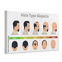 Male Pattern Hair Loss Poster Hair Loss Stage Vegetarian Hospital Beauty Salon Decoration Poster Canvas Poster Bedroom Decor Office Room Decor Gift Unframe-style 10x8inch(25x20cm)