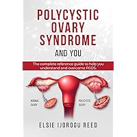 Polycystic Ovary Syndrome And You: The complete reference guide to help you understand and overcome PCOS Polycystic Ovary Syndrome And You: The complete reference guide to help you understand and overcome PCOS Kindle