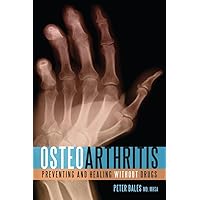 Osteoarthritis: Preventing and Healing Without Drugs Osteoarthritis: Preventing and Healing Without Drugs Paperback Kindle