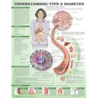 Understanding Type 2 Diabetes Anatomical Chart Understanding Type 2 Diabetes Anatomical Chart Wall Chart
