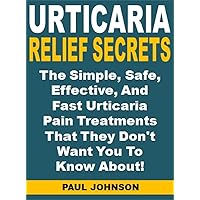Urticaria Relief Secrets: The Simple, Safe, Effective, And Fast Urticaria Pain Treatments That They Don't Want You To Know About!