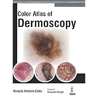 Colour Atlas of Dermoscopy Colour Atlas of Dermoscopy Hardcover Kindle