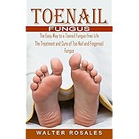 Toenail Fungus: The Easy Way to a Toenail Fungus-free Life (The Treatment and Cure of Toe Nail and Fingernail Fungus)