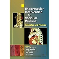 Endovascular Intervention for Vascular Disease: Principles and Practice Endovascular Intervention for Vascular Disease: Principles and Practice Hardcover Paperback