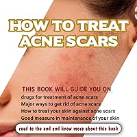 How to treat acne scars : Best way to treat scars