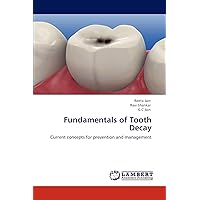 Fundamentals of Tooth Decay: Current concepts for prevention and management Fundamentals of Tooth Decay: Current concepts for prevention and management Paperback