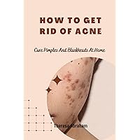 How To Get Rid Of Acne: Cure Pimples and Blackheads At Home How To Get Rid Of Acne: Cure Pimples and Blackheads At Home Kindle Paperback
