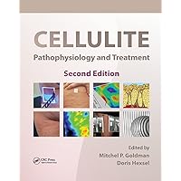 Cellulite: Pathophysiology and Treatment (Basic and Clinical Dermatology) Cellulite: Pathophysiology and Treatment (Basic and Clinical Dermatology) Paperback Kindle Hardcover