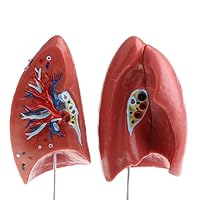 Teaching Model,1:1 Human Lung Anatomy Model with Pathologies Anatomy Model, Removable 4 Parts, Medical Study Kits, Classroom Decoration, Science Lab Ornament