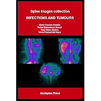 INFECTIONS AND TUMOURS : Spine images collection INFECTIONS AND TUMOURS : Spine images collection Kindle Paperback