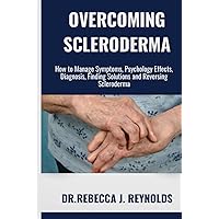 OVERCOMING SCLERODERMA: How to Manage Symptoms, Psychology Effects, Diagnosis, Finding Solutions and Reversing Scleroderma (Health Chronicles) OVERCOMING SCLERODERMA: How to Manage Symptoms, Psychology Effects, Diagnosis, Finding Solutions and Reversing Scleroderma (Health Chronicles) Paperback Kindle
