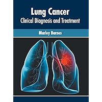 Lung Cancer: Clinical Diagnosis and Treatment Lung Cancer: Clinical Diagnosis and Treatment Hardcover