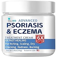 Psoriasis Eczema Cream, Eczema Cream for Adults, Extra Strength Control Reoccurrence, Relieve Symptom of Resistant, Effective for Seborrheic Dermatitis, Folliculitis Treatment
