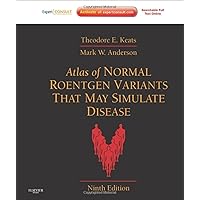 Atlas of Normal Roentgen Variants That May Simulate Disease Atlas of Normal Roentgen Variants That May Simulate Disease Hardcover Kindle