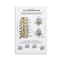 WENHUIMM Levels of Spinal Degeneration Chiropractors Spine Knowledge Guide Poster (2) Wall Poster Art Canvas Printing Poster Office Bedroom Aesthetic Poster Unframe-style 08x12inch(20x30cm)