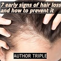 7 Early signs of hair loss and how to prevent it 7 Early signs of hair loss and how to prevent it Kindle