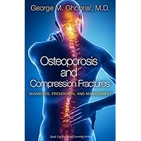 Osteoporosis and Compression Fractures: Diagnosis, Prevention, and Management Osteoporosis and Compression Fractures: Diagnosis, Prevention, and Management Paperback Kindle