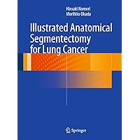 Illustrated Anatomical Segmentectomy for Lung Cancer Illustrated Anatomical Segmentectomy for Lung Cancer Kindle Paperback Hardcover