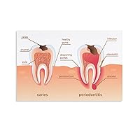 Periodontitis Cause Symptom Guidelines Poster Caries Care Poster Dental Clinic Poster Canvas Painting Posters And Prints Wall Art Pictures for Living Room Bedroom Decor 08x12inch(20x30cm) Unframe-sty