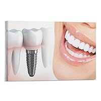Dental Implant Art, Dental Diagnostic Services, Dental Clinic, Dental Office Wall Art Decorative Posters Poster Decorative Painting Canvas Wall Art Living Room Posters Bedroom Painting 12x18inch(30x45
