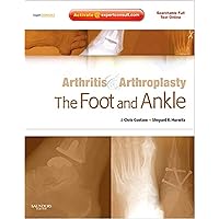 Arthritis and Arthroplasty: The Foot and Ankle: Expert Consult - Online, Print and DVD Arthritis and Arthroplasty: The Foot and Ankle: Expert Consult - Online, Print and DVD Hardcover