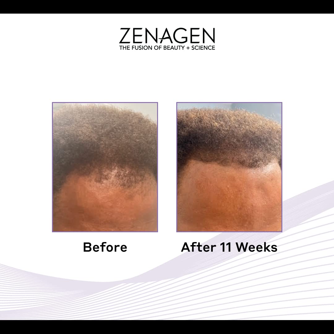 Zenagen Revolve Thickening Hair Loss Treatment for Men