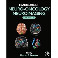 Handbook of Neuro-Oncology Neuroimaging Handbook of Neuro-Oncology Neuroimaging Hardcover Kindle