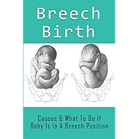 Breech Birth: Causes & What To Do If Baby Is In A Breech Position