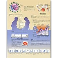 HIV and AIDS Anatomy Posters for Walls Nursing Students Educational Anatomical Poster Chart Waterproof Canvas Medicine Disease Map for Doctor Enthusiasts Kid's Enlightenment Education (HIV AND AIDS, 20x30inches)
