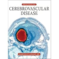 Principles of Cerebrovascular Disease Principles of Cerebrovascular Disease Hardcover