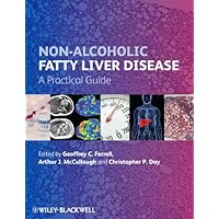 Non-Alcoholic Fatty Liver Disease: A Practical Guide Non-Alcoholic Fatty Liver Disease: A Practical Guide Kindle Hardcover