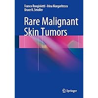 Rare Malignant Skin Tumors Rare Malignant Skin Tumors Kindle Hardcover Paperback