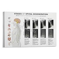 WENHUIMM Levels of Spinal Degeneration Chiropractors Spine Knowledge Guide Poster (4) Home Living Room Bedroom Decoration Gift Printing Art Poster Frame-style 30x20inch(75x50cm)