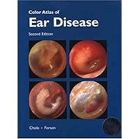 Color Atlas of Ear Disease Color Atlas of Ear Disease Kindle Hardcover