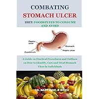 COMBATING STOMACH ULCER DIET: FOODSTUFFS TO CONSUME AND AVOID: A Guide on Practical Procedures and Outlines on How to Identify, Care and Treat Stomach Ulcer in Individuals