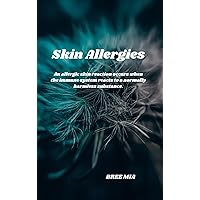 Skin Allergies: An allergic skin reaction occurs when the immune system reacts to a normally harmless substance. Skin Allergies: An allergic skin reaction occurs when the immune system reacts to a normally harmless substance. Kindle Hardcover Paperback
