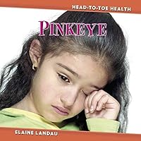 Pinkeye (Head-to-Toe Health) Pinkeye (Head-to-Toe Health) Library Binding