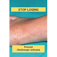 Stop Losing: Prevent Cholinergic Urticaria: Losing Itchy Hair Stop Losing: Prevent Cholinergic Urticaria: Losing Itchy Hair Paperback Kindle