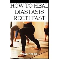 HOW TO CLOSE DIASTASIS RECTI FAST: An easy guide to healing diastasis recti, exercises to avoid and important lifestyle tips to get you back to shape HOW TO CLOSE DIASTASIS RECTI FAST: An easy guide to healing diastasis recti, exercises to avoid and important lifestyle tips to get you back to shape Paperback Kindle