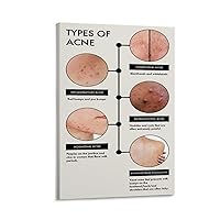 QOGAMGZD Identify The Type of Acne And How to Treat Acne Skin Knowledge Poster (2) Wall Poster Art Canvas Printing Gift Office Bedroom Aesthetic Poster 20x30inch(50x75cm) Frame-style