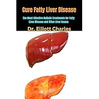 Cure Fatty Liver Disease: The Most Effective Holistic Treatments for Fatty Liver Disease and Other Liver Issues Cure Fatty Liver Disease: The Most Effective Holistic Treatments for Fatty Liver Disease and Other Liver Issues Kindle Paperback