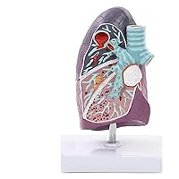 3D Human Lung Anatomical Model, Lung Cancer Model Pathology Lung Model, Teaching Model wirh Clear Texture & Accurate Anatomy Structure for Teaching Models Doctor-Patient Communicatio