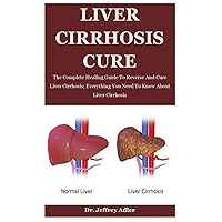 Liver Cirrhosis Cure: The Complete Healing Guide To Reverse And Cure Liver Cirrhosis; Everything You Need To Know About Liver Cirrhosis Liver Cirrhosis Cure: The Complete Healing Guide To Reverse And Cure Liver Cirrhosis; Everything You Need To Know About Liver Cirrhosis Paperback Kindle