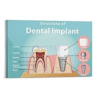Dental Clinic Poster Dental Health Poster Dental Implant Dental Care Poster (2) Canvas Painting Posters And Prints Wall Art Pictures for Living Room Bedroom Decor 08x12inch(20x30cm) Frame-style