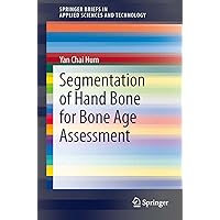 Segmentation of Hand Bone for Bone Age Assessment (SpringerBriefs in Applied Sciences and Technology) Segmentation of Hand Bone for Bone Age Assessment (SpringerBriefs in Applied Sciences and Technology) Kindle Paperback