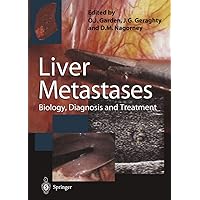 Liver Metastases: Biology, Diagnosis and Treatment Liver Metastases: Biology, Diagnosis and Treatment Kindle Hardcover Paperback