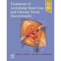 Treatment of Acetabular Bone Loss and Chronic Pelvic Discontinuity Treatment of Acetabular Bone Loss and Chronic Pelvic Discontinuity Hardcover Kindle