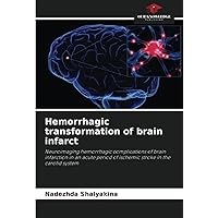 Hemorrhagic transformation of brain infarct: Neuroimaging hemorrhagic complications of brain infarction in an acute period of ischemic stroke in the carotid system